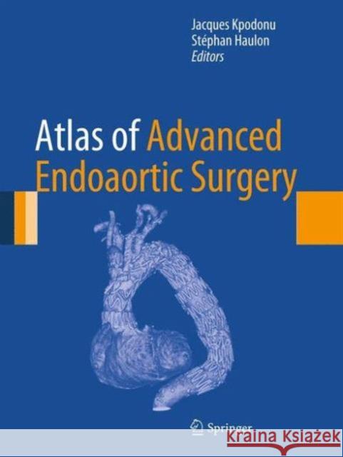 Atlas of Advanced Endoaortic Surgery Jacques Kpodonu St Phan Haulon 9781447140269 Springer, Berlin - książka
