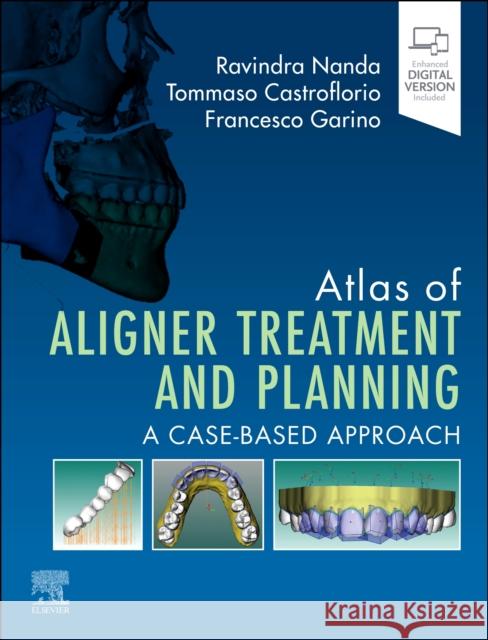 Atlas of Aligner Treatment and Planning: A Case-Based Approach Ravindra Nanda Tommaso Castroflorio Francesco Garino 9780443116087 Elsevier - książka