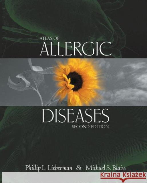 Atlas of Allergic Diseases Phillip L. Lieberman Phillip L. Lieberman Michael S. Blaiss 9781573402347 Current Medicine - książka