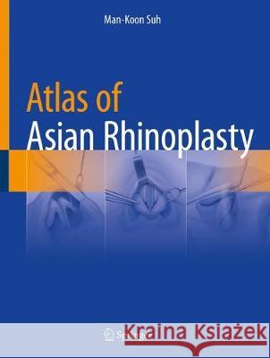 Atlas of Asian Rhinoplasty Man Koon Suh 9789811086441 Springer - książka