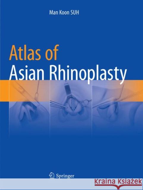 Atlas of Asian Rhinoplasty Man Koon Suh 9789811342042 Springer - książka