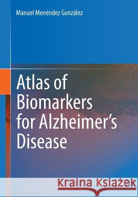 Atlas of Biomarkers for Alzheimer's Disease Manuel Menendez 9783319079882 Springer - książka