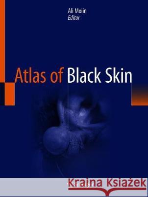 Atlas of Black Skin Ali Moiin 9783030314842 Springer - książka