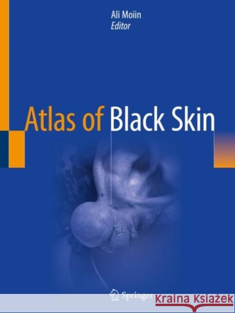 Atlas of Black Skin Ali Moiin 9783030314873 Springer - książka