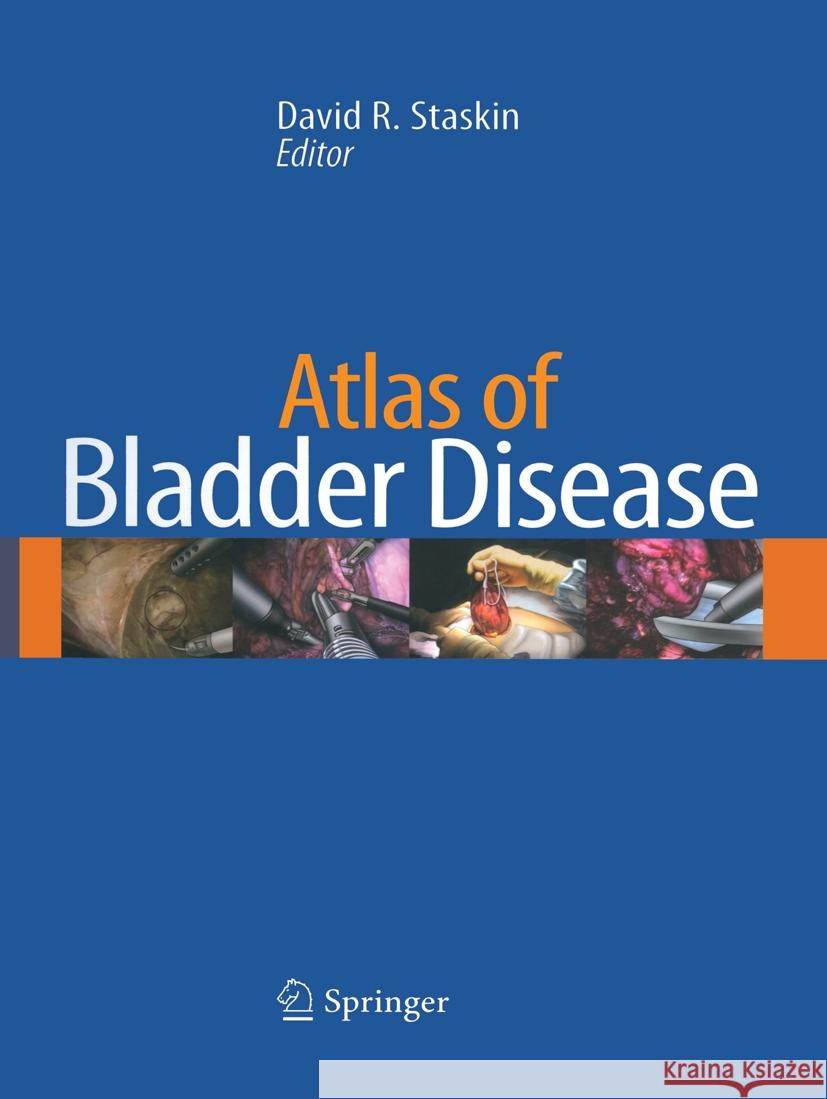 Atlas of Bladder Disease David Staskin 9781493939459 Current Medicine - książka