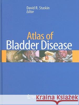 Atlas of Bladder Disease David Staskin 9781573403078 Current Medicine - książka