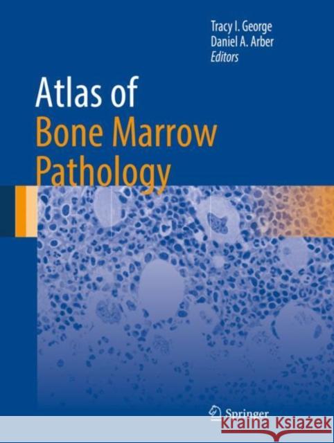 Atlas of Bone Marrow Pathology Tracy I. George Daniel A. Arber 9781493974672 Springer - książka