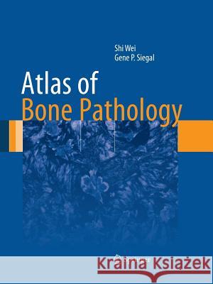 Atlas of Bone Pathology Shi Wei Gene P. Siegal 9781493942862 Springer - książka