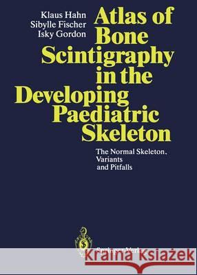 Atlas of Bone Scintigraphy in the Developing Paediatric Skeleton: The Normal Skeleton, Variants and Pitfalls Hahn, Klaus 9783642849473 Springer - książka
