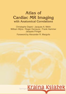 Atlas of Cardiac MR Imaging with Anatomical Correlations C. Depre J. a. Melin W. Wijns 9789401056854 Springer - książka