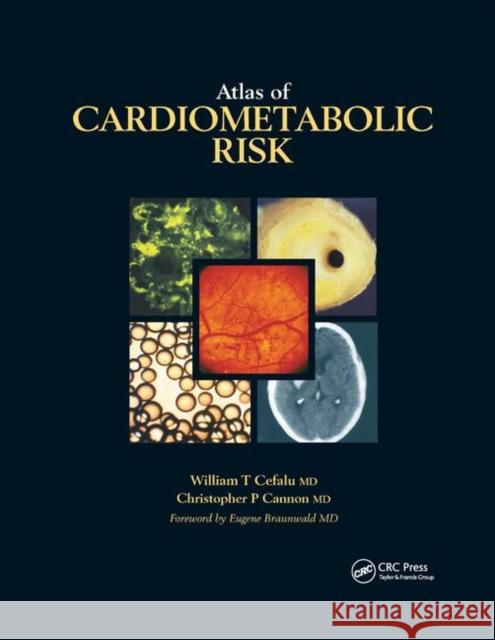 Atlas of Cardiometabolic Risk William T. Cefalu Christopher P. Cannon 9780367389246 CRC Press - książka