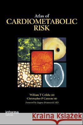 Atlas of Cardiometabolic Risk William T. Cefalu Christopher P. Cannon 9780849370533 Informa Healthcare - książka