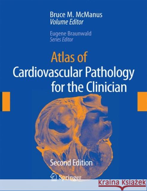 Atlas of Cardiovascular Pathology for the Clinician Bruce M. McManus Eugene Braunwald 9781573402798 Current Medicine - książka
