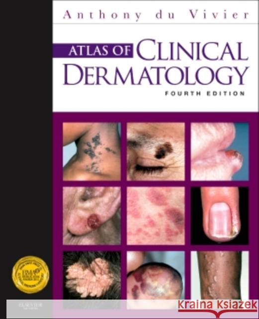 Atlas of Clinical Dermatology Anthony Du Vivier 9780702034213 SAUNDERS - książka