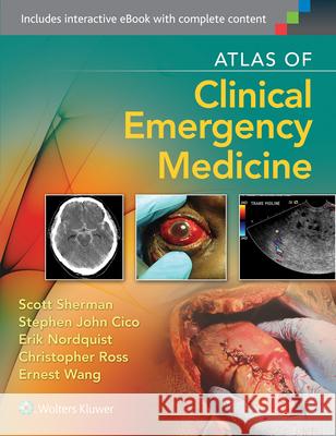 Atlas of Clinical Emergency Medicine Scott Sherman 9781451188820 Lippincott Williams & Wilkins - książka