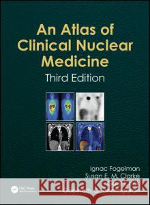 Atlas of Clinical Nuclear Medicine Ignac Fogelman 9781841846538  - książka