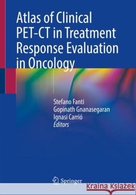 Atlas of Clinical Pet-CT in Treatment Response Evaluation in Oncology Stefano Fanti Gopinath Gnanasegaran Ignasi Carrio 9783030688578 Springer - książka