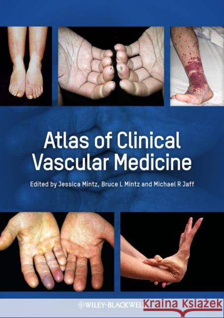 Atlas of Clinical Vascular Medicine Michael R Jaff 9780470658093  - książka