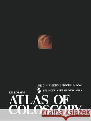 Atlas of Coloscopy Rossini 9781461596523 Springer - książka