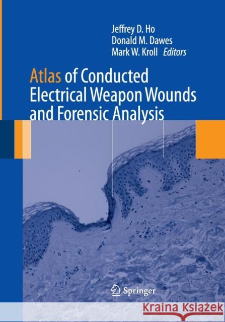 Atlas of Conducted Electrical Weapon Wounds and Forensic Analysis Jeffrey D. Ho Donald M. Dawes Mark W. Kroll 9781493941186 Springer - książka
