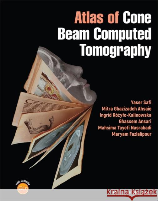 Atlas of Cone Beam Computed Tomography Yaser Safi Mitra G. Ahsaie Ingrid Roxylo-Kalinowska 9781119667773 Wiley-Blackwell - książka