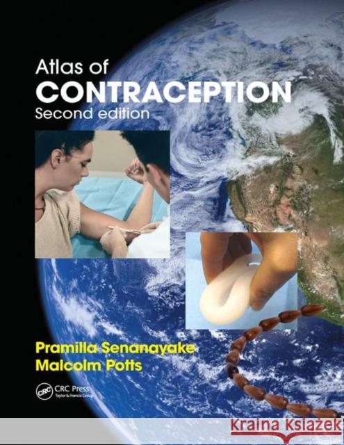 Atlas of Contraception Pramilla Senanayake Malcolm Potts 9780367387488 CRC Press - książka