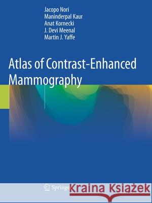 Atlas of Contrast-Enhanced Mammography Nori, Jacopo 9783030562656 Springer International Publishing - książka