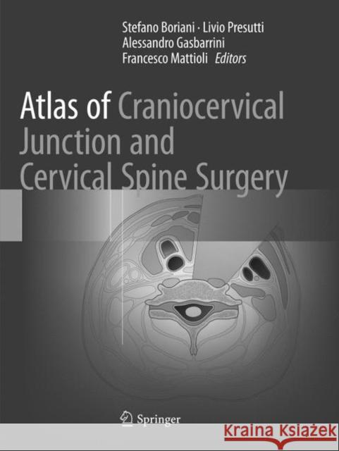 Atlas of Craniocervical Junction and Cervical Spine Surgery Stefano Boriani Livio Presutti Alessandro Gasbarrini 9783319826509 Springer - książka