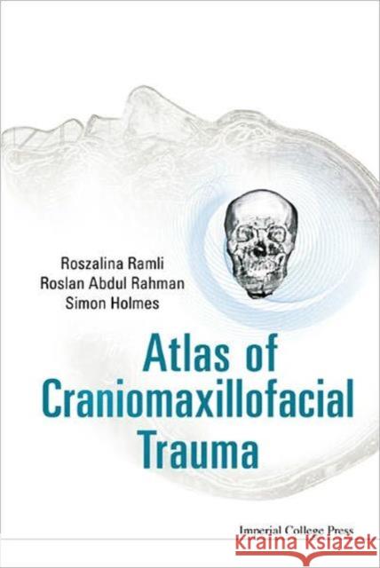 Atlas of Craniomaxillofacial Trauma Holmes, Simon 9781848165236 Imperial College Press - książka