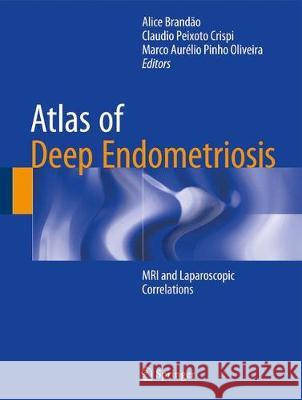 Atlas of Deep Endometriosis: MRI and Laparoscopic Correlations Brandão, Alice 9783319716961 Springer - książka