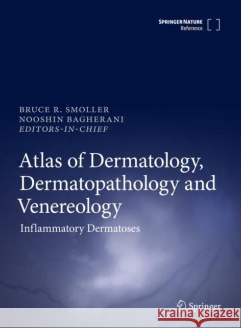 Atlas of Dermatology, Dermatopathology and Venereology: Inflammatory Dermatoses Smoller, Bruce 9783319538075 Springer - książka