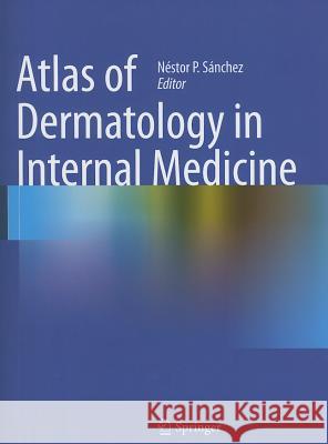 Atlas of Dermatology in Internal Medicine  Sanchez 9781461406877 Springer, Berlin - książka