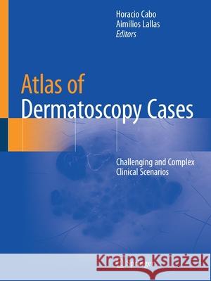 Atlas of Dermatoscopy Cases: Challenging and Complex Clinical Scenarios Horacio Cabo Aimilios Lallas 9783030436742 Springer - książka