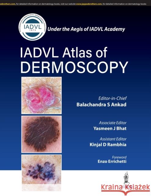 Atlas of Dermoscopy Balachandra S Ankad, Yasmeen J Bhat, Kinjal D Rambhia 9789390595648 Jaypee Brothers Medical Publishers - książka