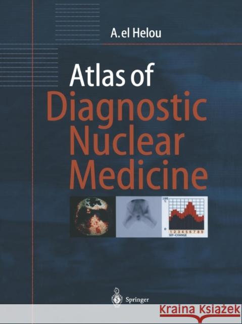 Atlas of Diagnostic Nuclear Medicine Anisah El Helou T. C. Telger H. Kriegel 9783662058893 Springer - książka