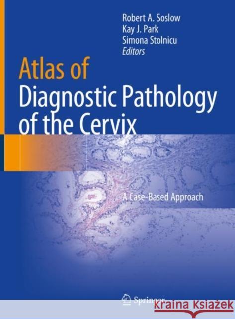 Atlas of Diagnostic Pathology of the Cervix: A Case-Based Approach Soslow, Robert A. 9783030499532 Springer - książka