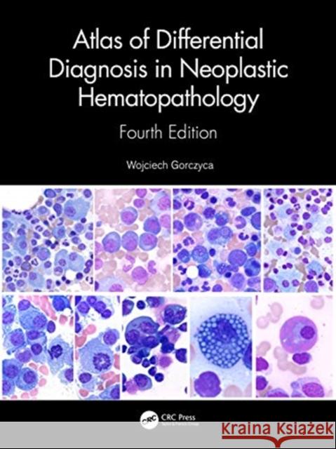 Atlas of Differential Diagnosis in Neoplastic Hematopathology Wojciech Gorczyca 9780367637248 CRC Press - książka