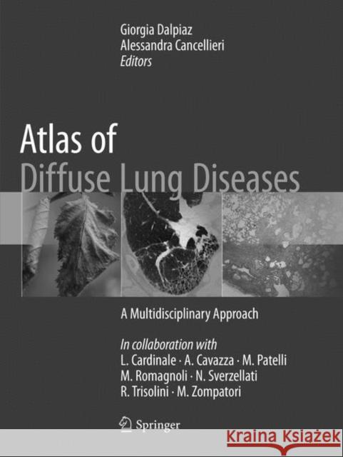Atlas of Diffuse Lung Diseases: A Multidisciplinary Approach Dalpiaz, Giorgia 9783319826547 Springer - książka