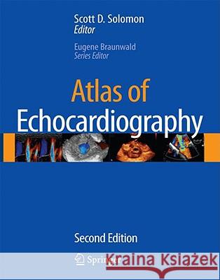 atlas of echocardiography  Solomon, Scott D. 9781573403238 Current Medicine - książka