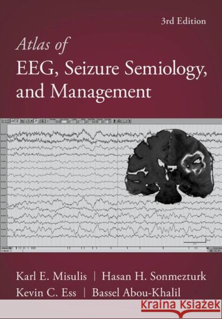 Atlas of Eeg, Seizure Semiology, and Management Bassel Abou-Khalil Karl Edward Misulis Hasan Sonmezturk 9780197543023 Oxford University Press, USA - książka