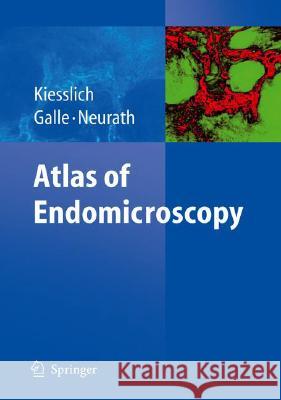 Atlas of Endomicroscopy Ralf Kiesslich Peter R. Galle M. F. Neurath 9783540347576 Not Avail - książka