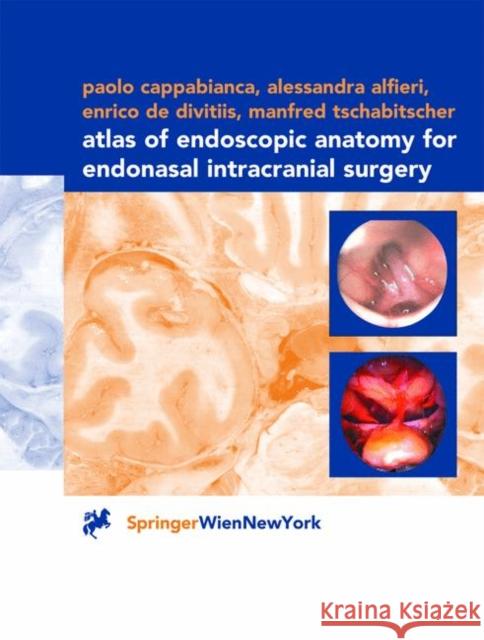 Atlas of Endoscopic Anatomy for Endonasal Intracranial Surgery Paolo Cappabianca Alessandra Alfieri Enrico d 9783211835487 Springer - książka