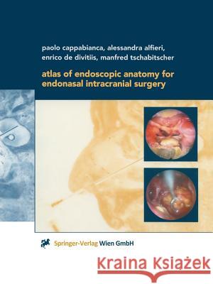 Atlas of Endoscopic Anatomy for Endonasal Intracranial Surgery Paolo Cappabianca Alessandra Alfieri Enrico de Divitiis 9783709172551 Springer - książka