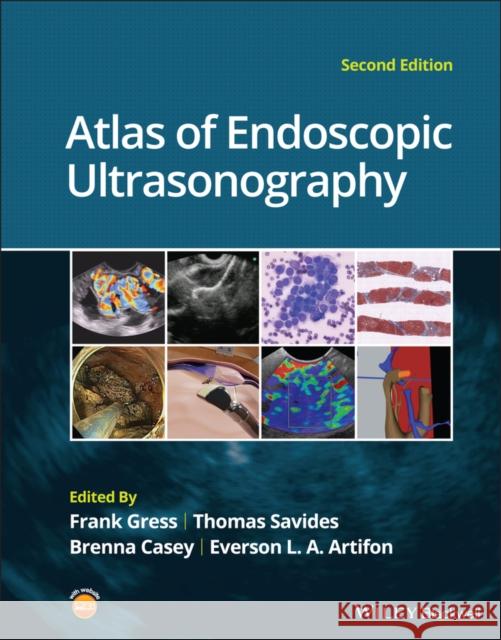 Atlas of Endoscopic Ultrasonography Frank G. Gress Thomas J. Savides Brenna Casey 9781119523000 John Wiley and Sons Ltd - książka