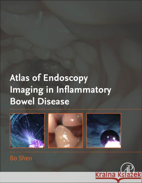 Atlas of Endoscopy Imaging in Inflammatory Bowel Disease Bo Shen 9780128148112 Academic Press - książka