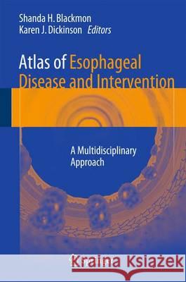 Atlas of Esophageal Disease and Intervention: A Multidisciplinary Approach Shanda H. Blackmon Karen J. Dickinson 9781493930876 Springer - książka