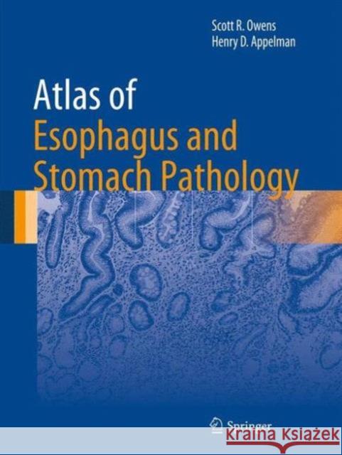 Atlas of Esophagus and Stomach Pathology Scott R. Owens Henry D. Appelman 9781461480839 Springer - książka