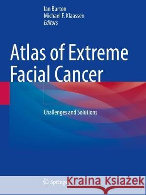 Atlas of Extreme Facial  Cancer  9783030883362 Springer International Publishing - książka