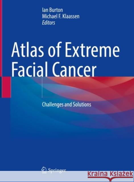 Atlas of Extreme Facial Cancer: Challenges and Solutions Burton, Ian 9783030883331 Springer Nature Switzerland AG - książka