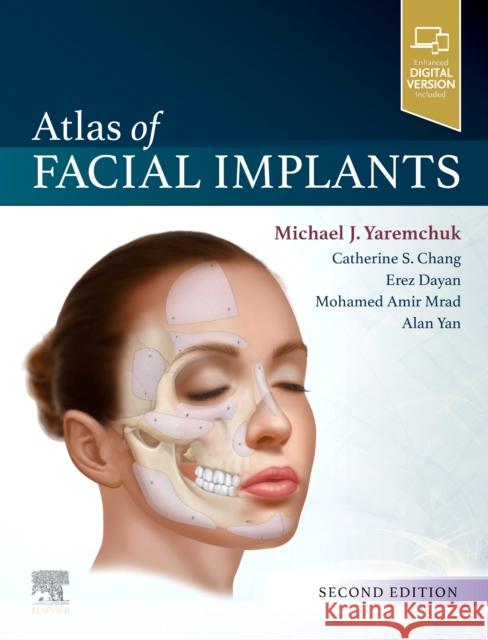 Atlas of Facial Implants Michael J. Yaremchuk 9780323624763 Elsevier - Health Sciences Division - książka